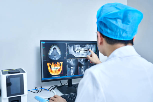 Best Emergency Wisdom Teeth Removal in Monroe, UT